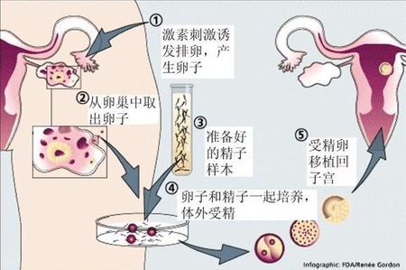 专家肖像